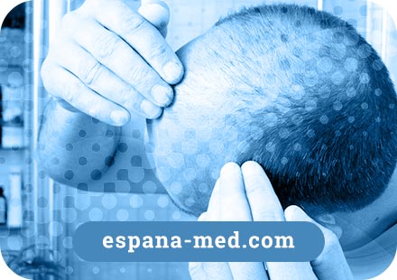 Propecia Online España